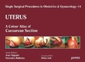 Cover: Single Surgical Procedures in Obstetrics and Gynaecology - Volume 14 - Uterus - Jaypee Brothers Medical Publishers