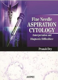 Abbildung von: Fine Needle Aspiration Cytology Interpretation and Diagnostic Difficulties - Jaypee Brothers Medical Publishers