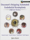Cover: Descemet's Stripping Automated Endothelial Keratoplasty: Different Strokes - Jaypee Brothers Medical Publishers