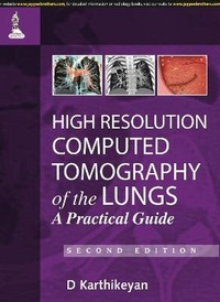 Enlarge image Cover: High Resolution Computed Tomography of the Lungs: A Practical Guide - Jaypee Brothers Medical Publishers