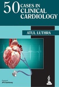 Cover: 50 Cases in Clinical Cardiology - Jaypee Brothers Medical Publishers