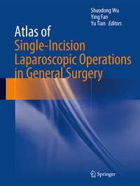 Abbildung von: Atlas of Single-Incision Laparoscopic Operations in General Surgery - Springer