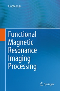 Abbildung von: Functional Magnetic Resonance Imaging Processing - Springer