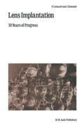 Cover: Lens Implantation - Springer