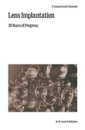 Cover: Lens Implantation - Kluwer Academic Publishers