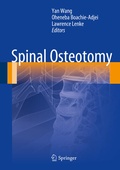 Cover: Spinal Osteotomy - Springer