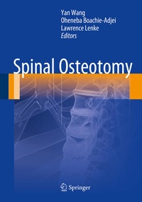 Enlarge image Cover: Spinal Osteotomy - Springer