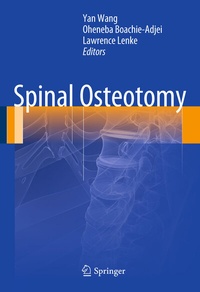 Abbildung von: Spinal Osteotomy - Springer