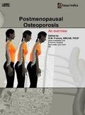 Abbildung von: Postmenopausal Osteoporosis - Focus Medica Pte Ltd