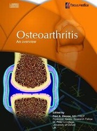 Enlarge image Cover: Osteoarthritis - Focus Medica Pte Ltd