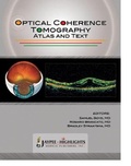 Cover: Optical Coherence Tomography - Jaypee Highlights