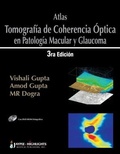 Cover: Atlas - Tomografia de Coherencia Optica en Patologia Macular y Glaucoma - Jaypee Highlights