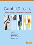 Cover: Carotid Disease - Cambridge University Press