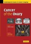 Cover: Cancer of the Ovary - Cambridge University Press