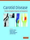Cover: Carotid Disease - Cambridge University Press
