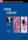 Cover: Lung Cancer - Cambridge University Press