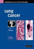 Bild: Lung Cancer - Cambridge University Press
