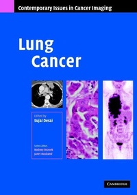 Enlarge image Cover: Lung Cancer - Cambridge University Press