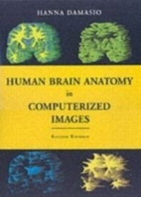 Abbildung von: Human Brain Anatomy in Computerized Images - OUP eBook