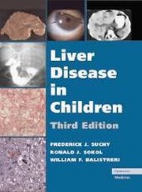 Abbildung von: Liver Disease in Children - Cambridge University Press