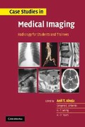 Cover: Case Studies in Medical Imaging - Cambridge University Press