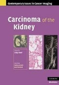 Cover: Carcinoma of the Kidney - Cambridge University Press