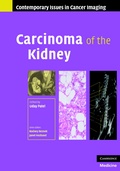Cover: Carcinoma of the Kidney - Cambridge University Press