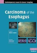 Cover: Carcinoma of the Esophagus - Cambridge University Press
