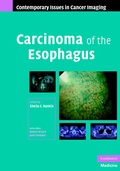 Cover: Carcinoma of the Esophagus - Cambridge University Press