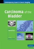 Cover: Carcinoma of the Bladder - Cambridge University Press