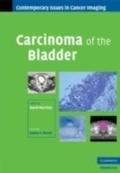 Cover: Carcinoma of the Bladder - Cambridge University Press