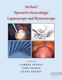 Abbildung von: Nezhat's Operative Gynecologic Laparoscopy and Hysteroscopy - Cambridge University Press