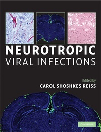 Abbildung von: Neurotropic Viral Infections - Cambridge University Press