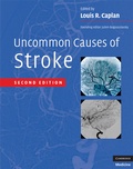 Cover: Uncommon Causes of Stroke - Cambridge University Press