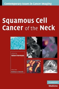 Enlarge image Cover: Squamous Cell Cancer of the Neck - Cambridge University Press