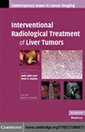 Cover: Interventional Radiological Treatment of Liver Tumors - Cambridge University Press