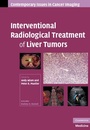 Cover: Interventional Radiological Treatment of Liver Tumors - Cambridge University Press