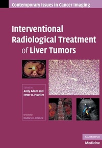 Enlarge image Cover: Interventional Radiological Treatment of Liver Tumors - Cambridge University Press