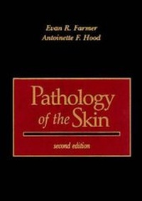Abbildung von: Pathology of the Skin - Appleton & Lange