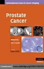 Cover: Prostate Cancer - Cambridge University Press