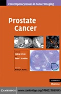 Cover: Prostate Cancer - Cambridge University Press