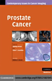 Enlarge image Cover: Prostate Cancer - Cambridge University Press