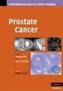 Cover: Prostate Cancer - Cambridge University Press