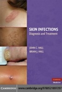 Enlarge image Cover: Skin Infections - Cambridge University Press