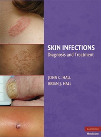 Enlarge image Cover: Skin Infections - Cambridge University Press