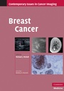 Cover: Breast Cancer - Cambridge University Press