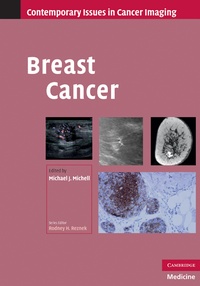 Enlarge image Cover: Breast Cancer - Cambridge University Press