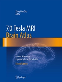 Abbildung von: 7.0 Tesla MRI Brain Atlas - Springer