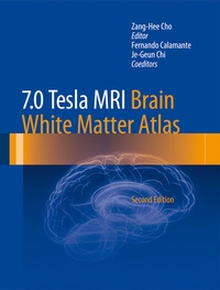 Abbildung von: 7.0 Tesla MRI Brain White Matter Atlas - Springer