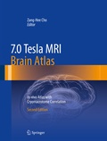 Abbildung von: 7.0 Tesla MRI Brain Atlas - Springer